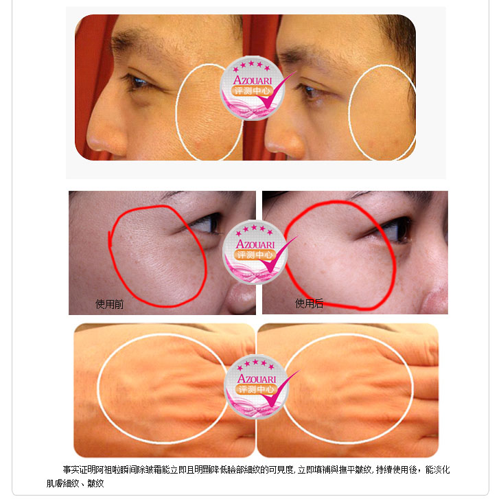 阿祖啦瞬间抗皱除纹霜正品15g 修复皱纹去面部干纹去眼部细纹滋养 【图片 价格 品牌 报价】