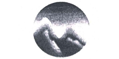 冰山