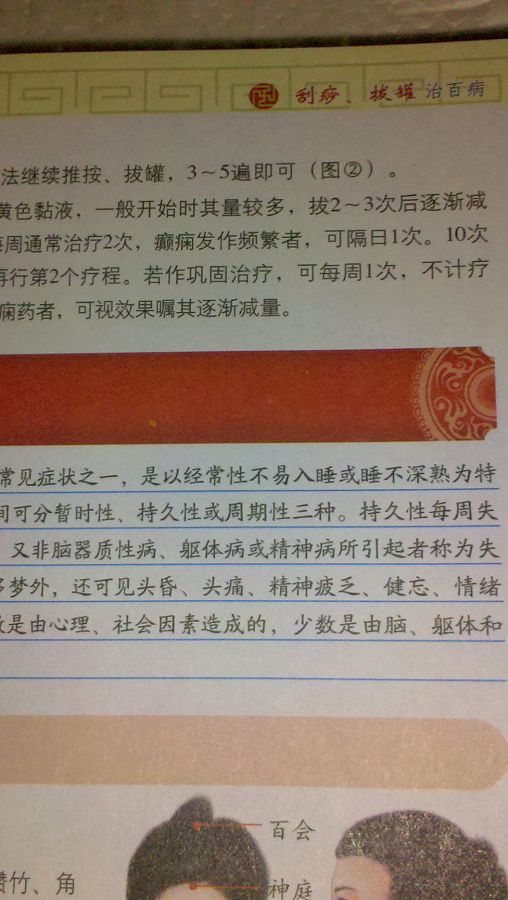 國醫絕學(xué)一日通系列叢書(shū)7：刮痧、拔罐治百病 曬單實(shí)拍圖