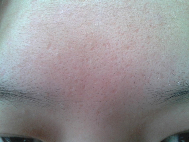 比度克BeDOOK 去黑头导出液30g(清洁毛孔去