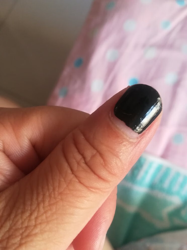 还可以,不过用胶布粘上半天,可以整个接下来。早知道就不用买卸甲水了。