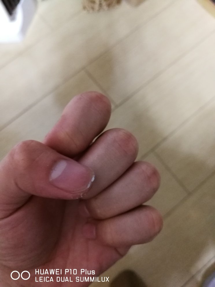 用的时候一不小心摔了下,然后钢化膜碎了,换钢化膜的时候弄不下来,还使得指甲被磨坏