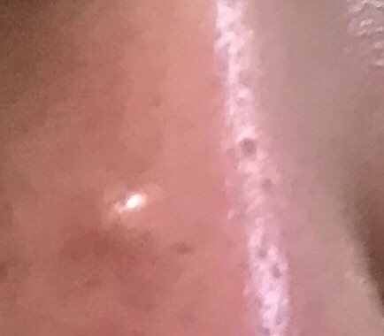 效果蛮好的,我是长了一个很大的脓肿包,用封闭针戳了,然后一贴。第二天立竿见影,回购!!!!好用!!!!再也不用担心了