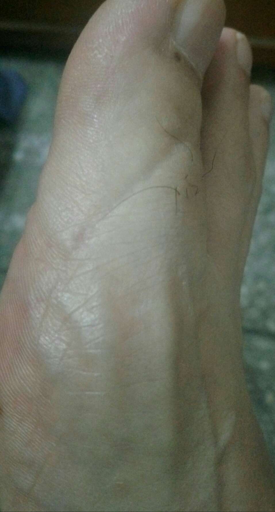 这鞋穿一天,我都不敢走路了!大脚趾被夹得一道杆,后脚跟起水泡~~~我去!女人穿的鞋么,这么窄!