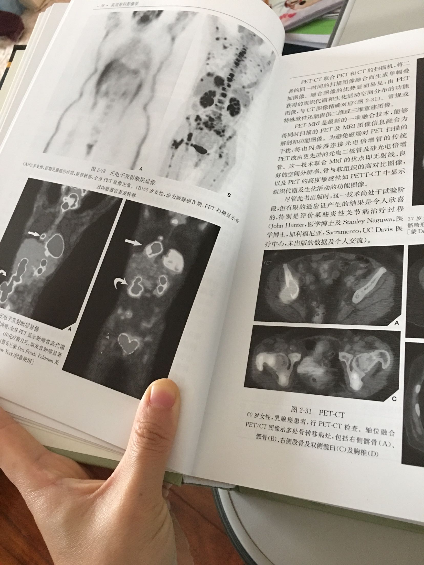 非常方便快捷,收到的书没任何损坏,纸张质量非常好。一直值得信赖,快递小哥的服务也非常好,比普通快递的投递服务好很多。这本有小磕坏,但不影响学习知识就不换了