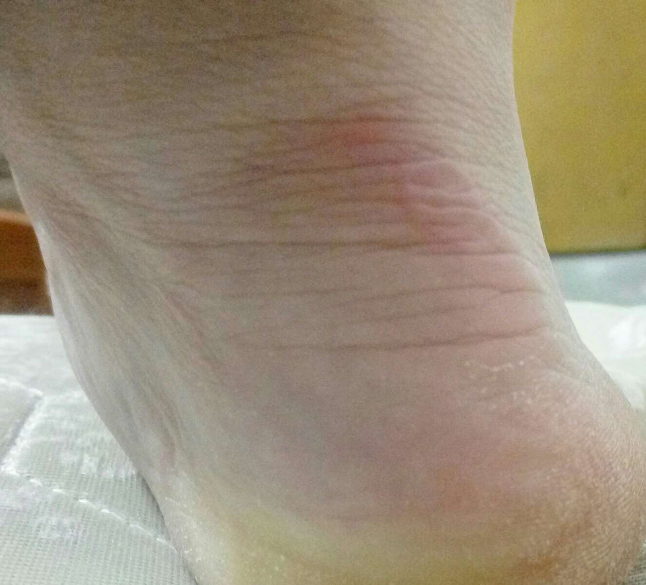 这鞋穿一天,我都不敢走路了!大脚趾被夹得一道杆,后脚跟起水泡~~~我去!女人穿的鞋么,这么窄!