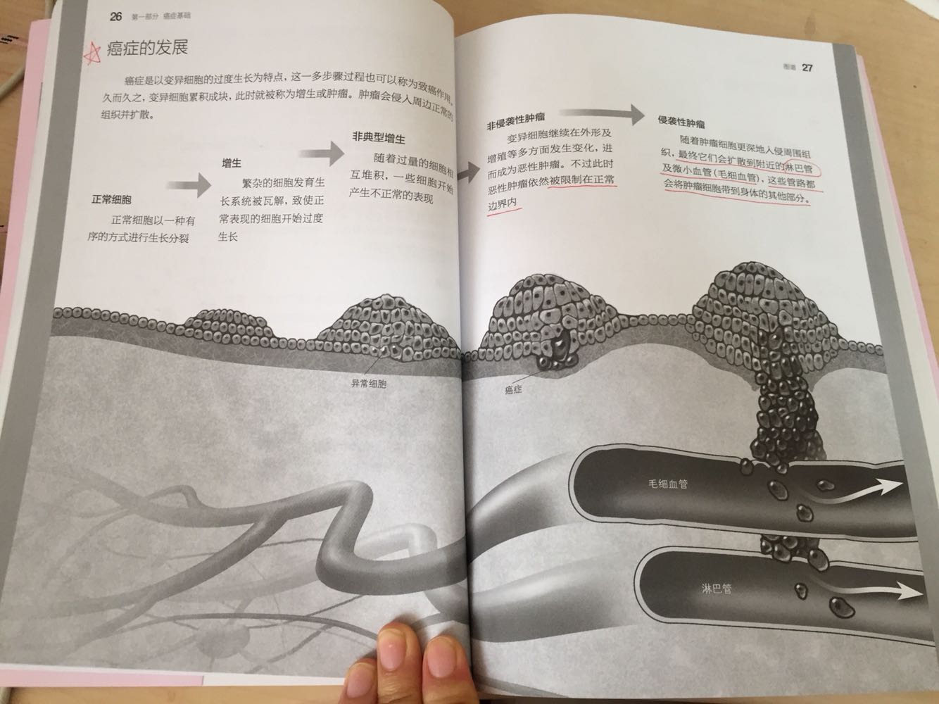 这本书是美国最权威的癌症研究机构之一,Mayo Cancer Clinic撰写,由北京协和医院专家及团队翻译。这是妈妈生病后我看的第一本书,非常非常推荐!全书章节清晰完整,从预防-患病前期-乳腺癌分类-手术治疗方案-术后辅助治疗方案-复发及治疗-延伸的宫颈癌等疾病-心理安慰等方面,用最易懂的语言和图片,像患者及家属全面讲解了乳腺癌。了解了该如何选择手术,如何读懂病理报告单,每个指标分别说明了什么。对疾病的充分了解也会减少患者和家属的恐惧,能够更好的选择治疗方案,听从医生的建议。这个时候,在妈妈被病魔打击的特别脆弱的时候,我要做到临危不乱,我要成为她坚强的臂膀!这本书2017年1月第一次出版,所以我认为书中介绍的治疗方法,一定已经是全世界最前沿的方法了。让我放心的是,医院给出的治疗方案,和书中介绍的无异,也就说明妈妈接受的已经是最前沿和最有效的治疗了!
