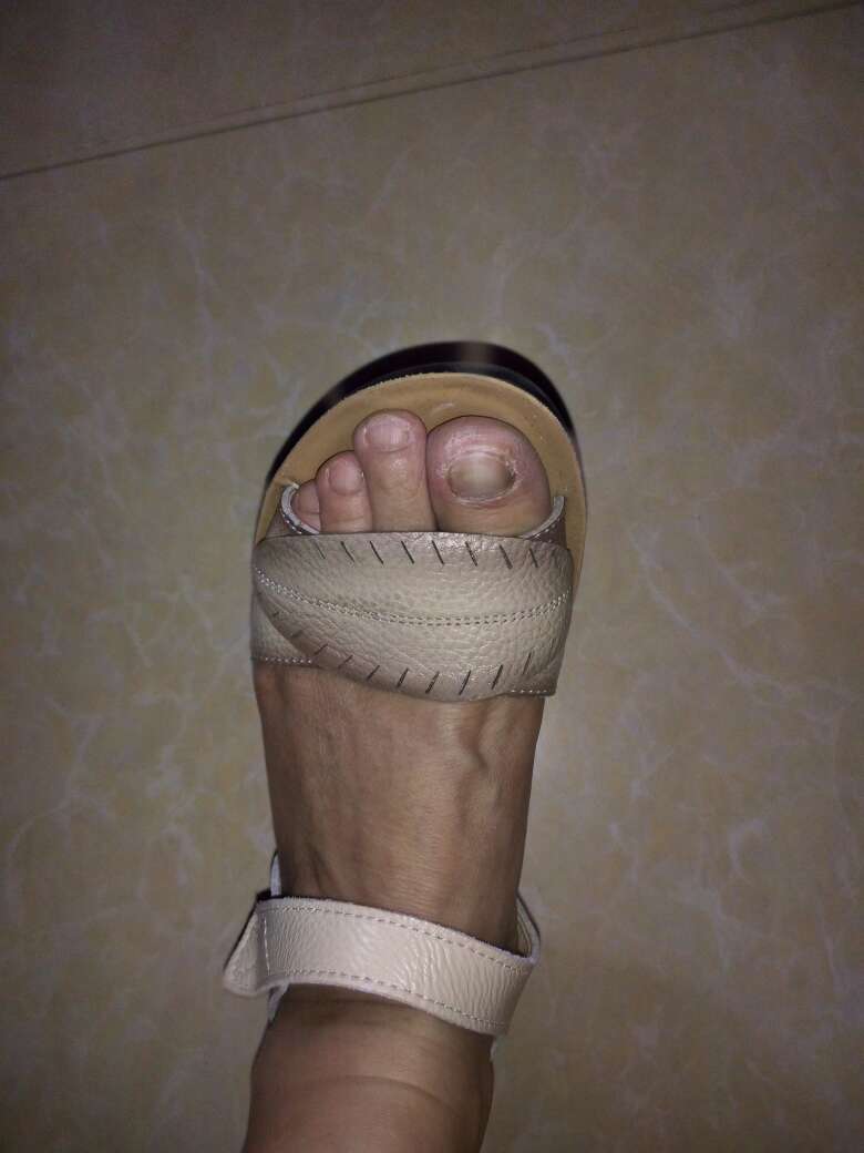 穿了一次感觉不错,就是走路快了,右脚第二脚趾磨破皮啦