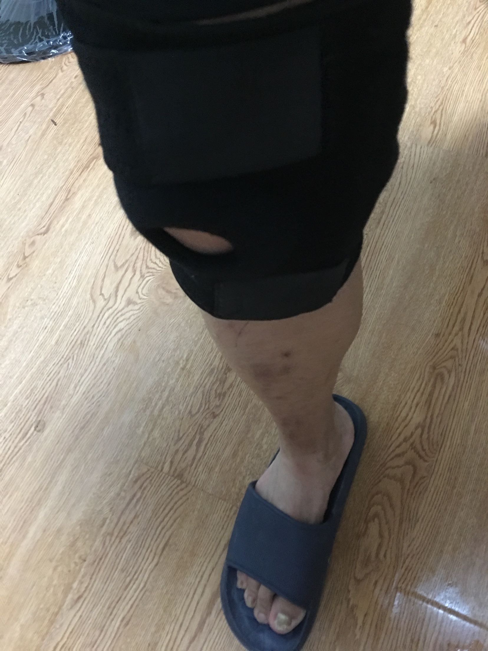买回来这么久第一次用,还是有点效果。