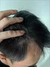 香港大藥房烏參育發(fā)丸中年少年產(chǎn)后白發(fā)熬夜掉發(fā)純草本植物養護禿頭地中海 【5盒周期裝】98%人群的選擇 曬單實(shí)拍圖