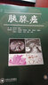 胰腺癌(AME科研時(shí)間系列醫學(xué)圖書(shū)) 曬單實(shí)拍圖
