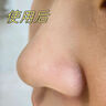 華美科 HURMEVKOR黑頭清理神器鼻貼去黑頭修復(fù)毛孔收縮毛孔粉刺深層清潔黑頭導(dǎo)出液 毛孔凈澈去黑頭護(hù)理套盒*2 曬單實(shí)拍圖