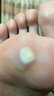 Carelead供疣體脖子上長(cháng)小肉粒疙瘩非去除膏瘊刺肉腳底手上猴疣趾跖根征尤 征尤 征尤1盒 曬單實(shí)拍圖
