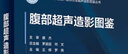 腹部超聲造影圖鑒 曬單實(shí)拍圖