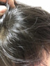 童貝恩騷子藥滅虱子兒童跳蚤藥小孩頭上長虱子藥女孩頭發(fā)上有廝子戒虱凈 虱立清 曬單實(shí)拍圖