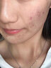妍綺氨基酸洗面奶清潔皮膚垃圾毛孔粗大黑頭粉刺痘痘男女士可用潔面乳 1支 曬單實(shí)拍圖