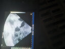 豬博士豬用b超機獸用B超測孕儀母豬彩超機便攜式寵物懷孕診斷儀 16色高配款（機械探頭) 曬單實(shí)拍圖
