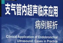 支氣管內(nèi)超聲臨床應(yīng)用病例解析 曬單實(shí)拍圖