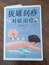拔罐刮痧對癥治療保健全書(shū)（新版） 曬單實(shí)拍圖