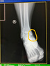 李寧音速7代玫瑰之城V2籃球鞋CJ麥科勒姆韋德之道玫瑰花城 朱砂紅-2 44 曬單實(shí)拍圖