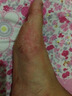 達(dá)克寧腳氣藥止癢脫皮爛腳丫真菌感染治療腳氣特專用效藥腳氣藥止癢脫皮爛腳丫抗真菌感染根專硝酸咪康唑乳膏 1盒【達(dá)克寧治腳氣】 曬單實(shí)拍圖