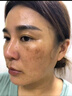 老年斑專用膏藥一夜消強(qiáng)力去除老年斑臉部手背祛斑專用霜去老人 1 一盒【淡化各種老年斑 曬單實(shí)拍圖