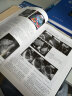 实用腹部超声诊断学（第2版） 实拍图