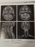 MRI讀片指南（臨床影像診斷叢書(shū)） 曬單實(shí)拍圖