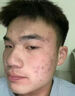 HIEUAILR祛痘洗面奶控油祛痘除螨蟲(chóng)去黑頭縮毛孔男女士氨基酸潔面乳去角質(zhì) 一盒裝【控油祛痘保濕】 曬單實(shí)拍圖