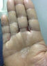 治香虎手藥膏手指真菌感染攪拌魚餌引起嚴重蛻皮干燥起皮皸裂手指水泡手指潰爛癢硝酸咪康唑乳膏 3盒【潰爛 小水泡】療程裝 曬單實拍圖