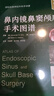 鼻內鏡鼻竇顱底手術(shù)圖譜 原書(shū)第2版 國際經(jīng)典神經(jīng)外科學(xué)譯著(zhù) 曬單實(shí)拍圖