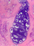 Phenix凤凰三目生物显微镜PH100-3B41L-IPL专业级无限远光学系统高倍高清实验室医学用 套餐二：显微镜+500万摄像素USB2.0连接电脑 实拍图