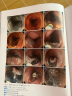 食管·胃·十二指肠ESD：操作、诊断和治疗基础与技巧   ESD，内镜黏膜下剥离术，消化内镜 北京科学技术 实拍图
