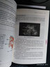 快速上手——超聲引導區域阻滯和血管穿刺技術(shù) 曬單實(shí)拍圖