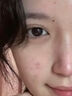 維特絲愈創(chuàng  )木祛痘控油修護保濕乳液淡化痘印去痘痘收縮毛孔男女士護膚品 曬單實(shí)拍圖