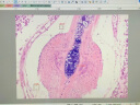 Phenix凤凰三目生物显微镜PH100-3B41L-IPL专业级无限远光学系统高倍高清实验室医学用 套餐二：显微镜+500万摄像素USB2.0连接电脑 实拍图