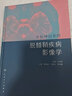 中樞神經(jīng)系統脫髓鞘疾病影像學(xué) 曬單實(shí)拍圖