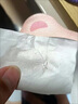 AOPY去黑頭三件套寡肽鼻貼鼻膜液黑頭導(dǎo)出液收縮毛孔精華液去粉刺男女 1盒裝去黑頭三件套 曬單實(shí)拍圖