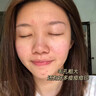 EXPRESSIONS進(jìn)口除螨蟲(chóng)祛痘氨基酸洗面奶控油男女士去黑頭縮毛孔潔面乳200g 曬單實(shí)拍圖