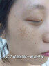七味堂煙酰胺美白祛斑淡化黑色素去雀斑黃褐斑淡斑去斑提亮膚色補水保濕 5瓶裝【250g】買(mǎi)3贈2 曬單實(shí)拍圖