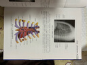 全身血管影像解剖學(xué)圖譜9787117163088 曬單實(shí)拍圖