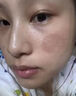 DR.SOKK濕疹藥膏皮膚瘙癢皮炎皮癬真菌感染止癢膏頑固去根陰囊潮濕肛門 曬單實拍圖