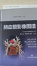 肺血管影像圖譜 曬單實(shí)拍圖