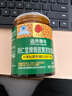 同仁堂蜂膠黃芪輔助保護(hù)胃黏膜養(yǎng)胃護(hù)胃舒緩胃痛胃脹消化不適反酸*1瓶 曬單實拍圖