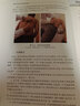 【套裝2冊】 浮針醫(yī)學(xué)綱要+浮針療法治療疼痛手冊 人衛(wèi)版 符仲華著 人民衛(wèi)生出版社 中醫(yī)針灸 針刺9787117141130 曬單實拍圖