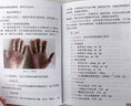 實用皮膚科醫(yī)師手冊（彩色圖解版） 曬單實拍圖