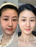 婭芝美白精粹發(fā)光水補水保濕濕敷水熬夜提亮收毛孔爽膚水清爽控油女 發(fā)光精粹水 400ml *1瓶體驗裝 曬單實拍圖