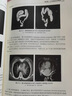 全國醫(yī)用設備 成像原理與臨床應用第2版人衛(wèi)第二版使用人員醫(yī)學技術醫(yī)院大型上崗證ct技師診斷學磁共振b超人民衛(wèi)生出版社超聲書籍 曬單實拍圖