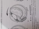 眼底病手術(shù)學(xué)第2二版玻璃體晶狀體視網(wǎng)膜脫落眼底激光眼科學(xué)白內障眼外傷眼科顯微手術(shù)學(xué)人衛社書(shū)籍 曬單實(shí)拍圖