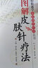 圖解皮膚針療法 曬單實(shí)拍圖